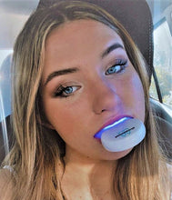 Load image into Gallery viewer, Sparklewhite Teeth Home Whitening Kit